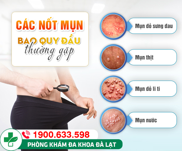 Hình ảnh minh họa