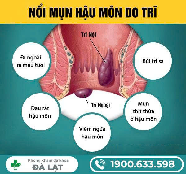 Hình ảnh minh họa