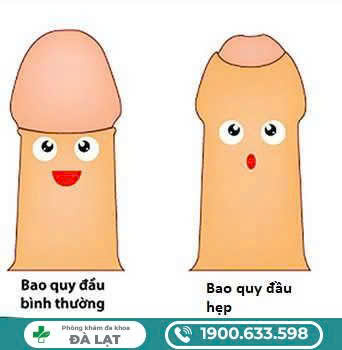 Hình ảnh minh họa