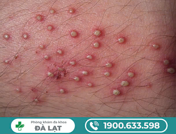 Hình ảnh minh họa