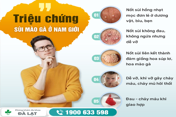 Hình ảnh minh họa