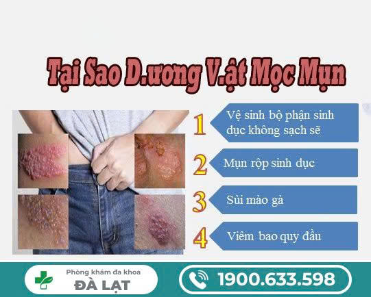 Hình ảnh minh họa