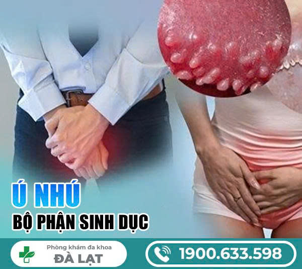 Hình ảnh minh họa