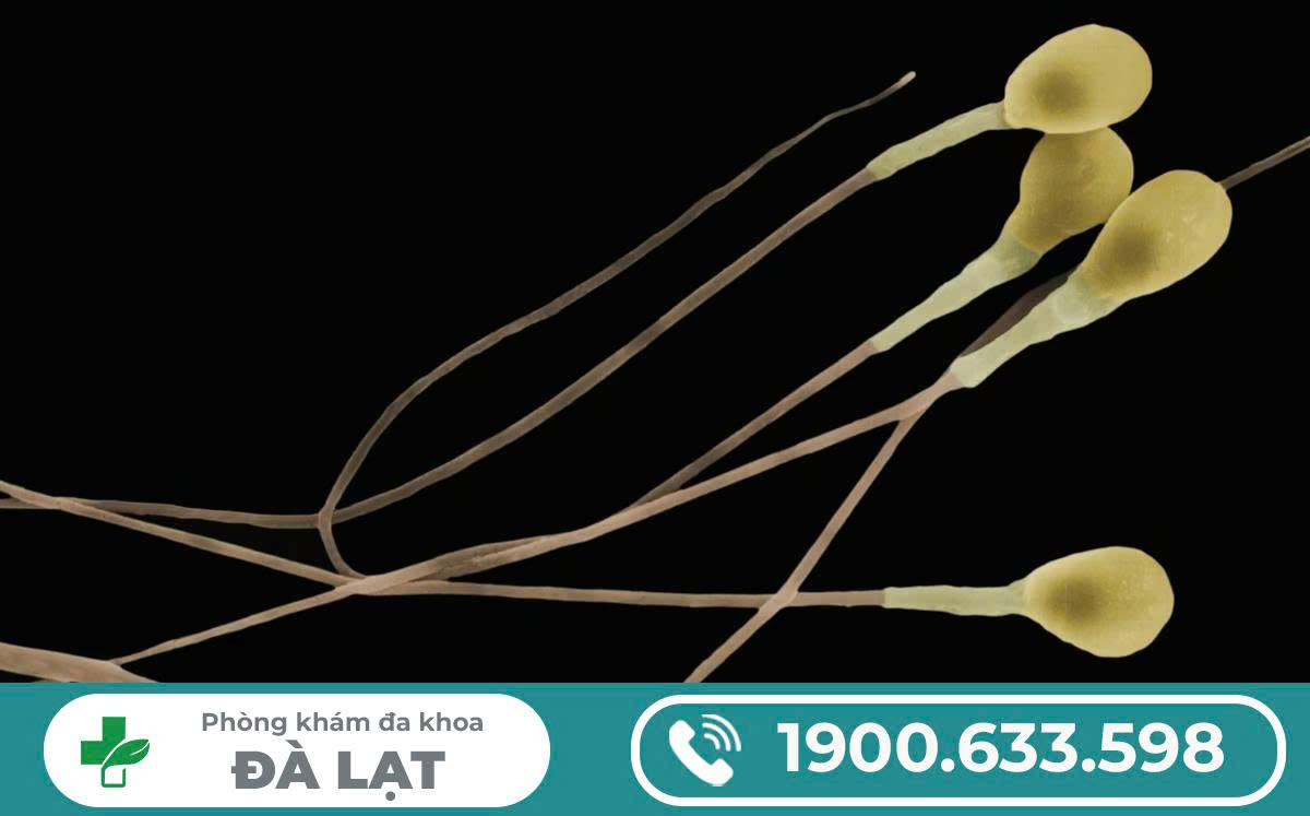 Hình ảnh minh họa