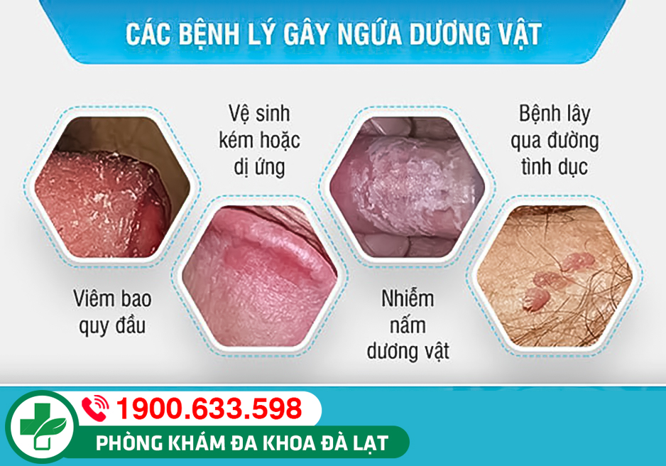 Hình ảnh minh họa