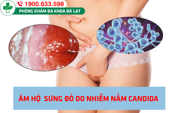 Hình ảnh minh họa