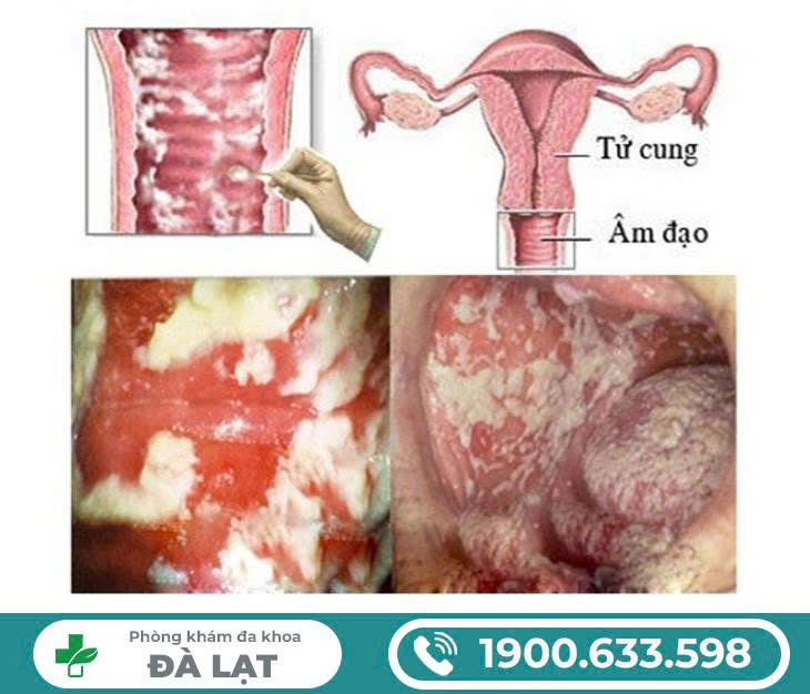 Hình ảnh minh họa