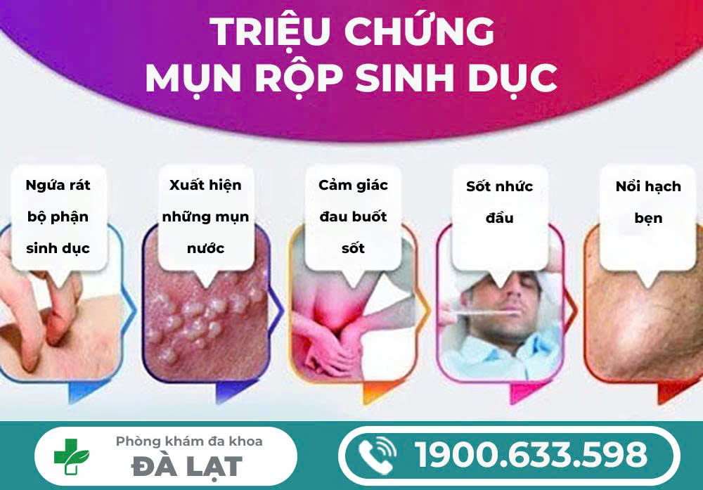 Hình ảnh minh họa