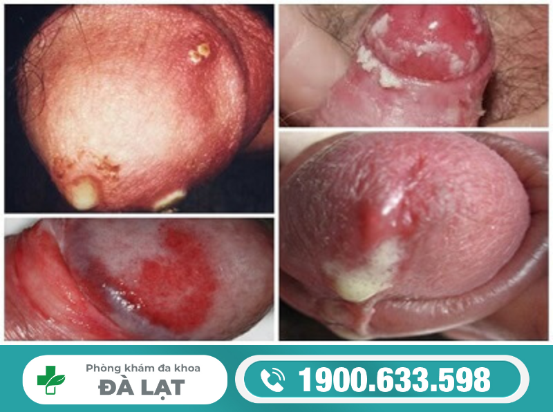 Hình ảnh minh họa