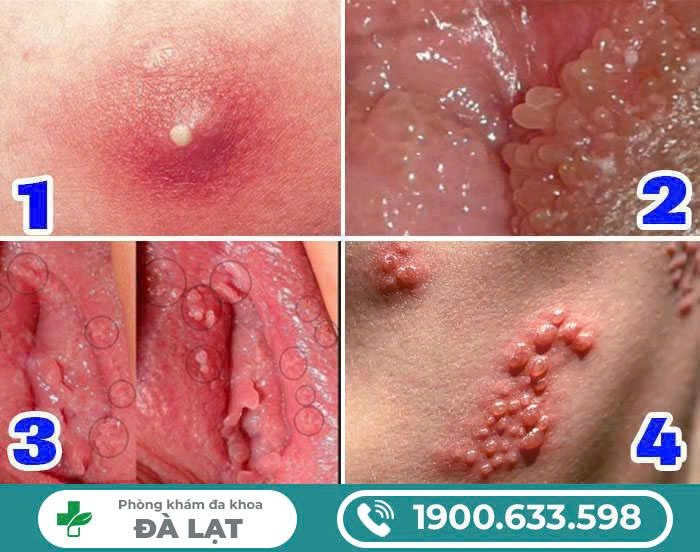 Hình ảnh minh họa