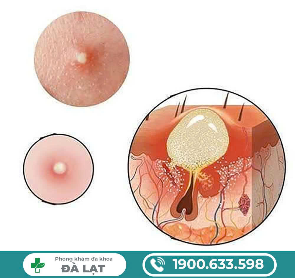 Hình ảnh minh họa