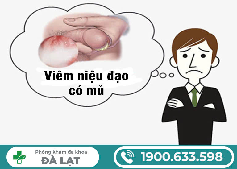 Hình ảnh minh họa