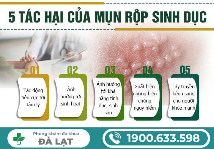 Hình ảnh minh họa