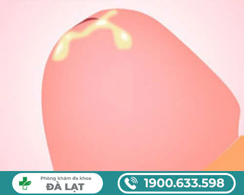 Hình ảnh minh họa