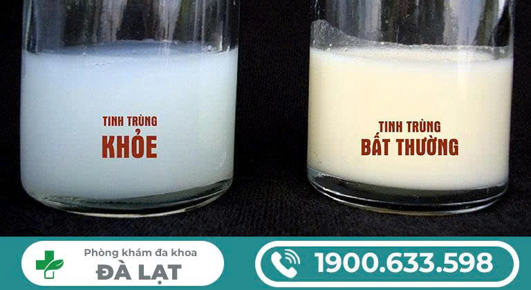 Hình ảnh minh họa