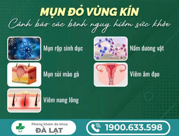 Hình ảnh minh họa