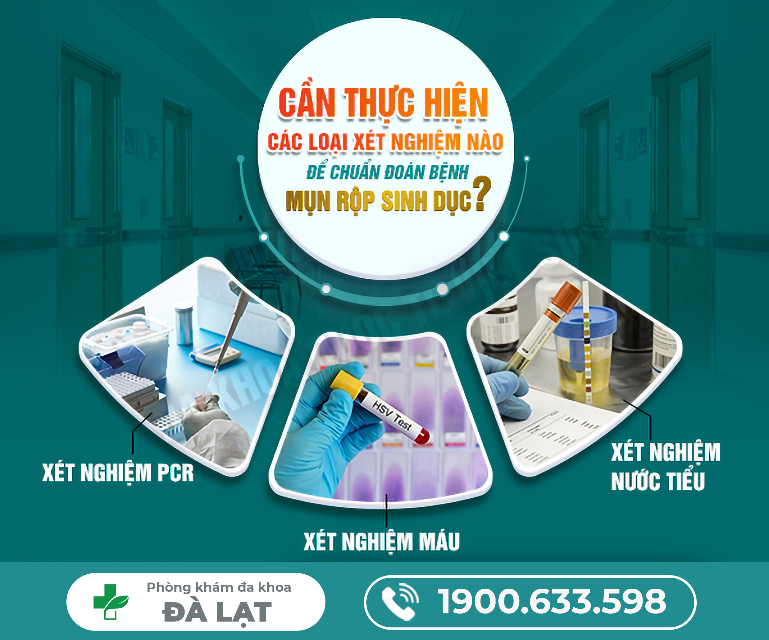 Hình ảnh minh họa