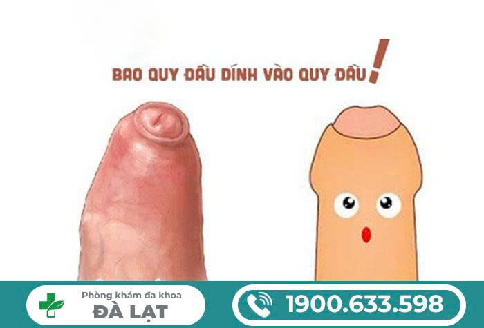 Hình ảnh minh họa