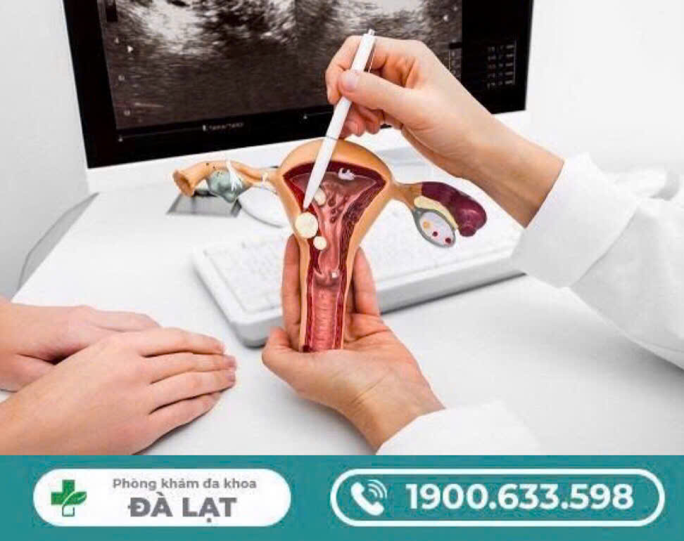 Hình ảnh minh họa