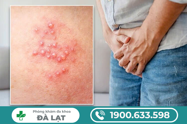 Hình ảnh minh họa