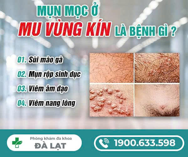 Hình ảnh minh họa