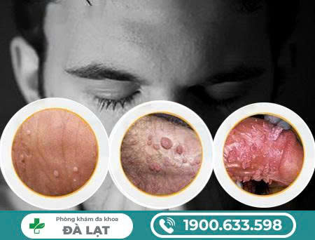 Hình ảnh minh họa