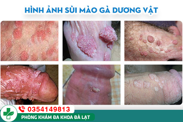 Hình ảnh minh họa