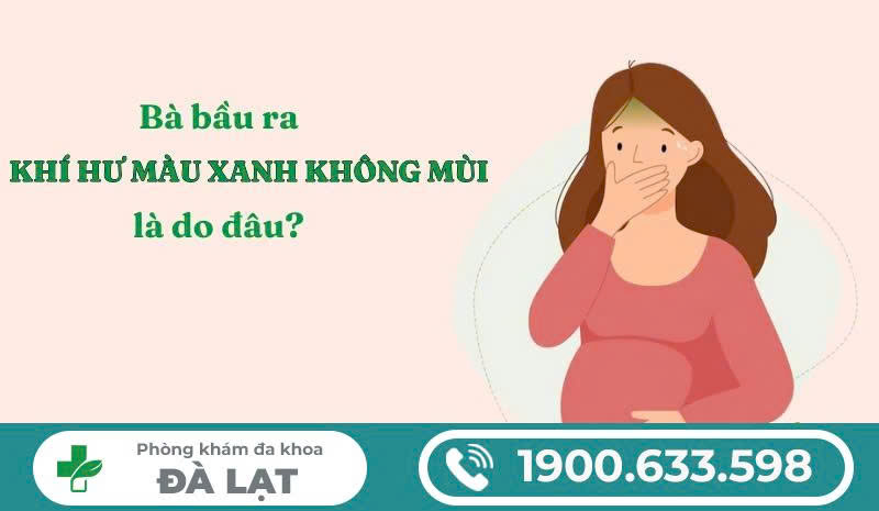 Hình ảnh minh họa