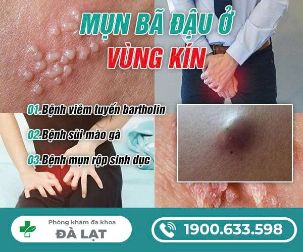 Hình ảnh minh họa