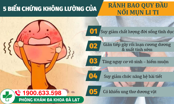 Hình ảnh minh họa