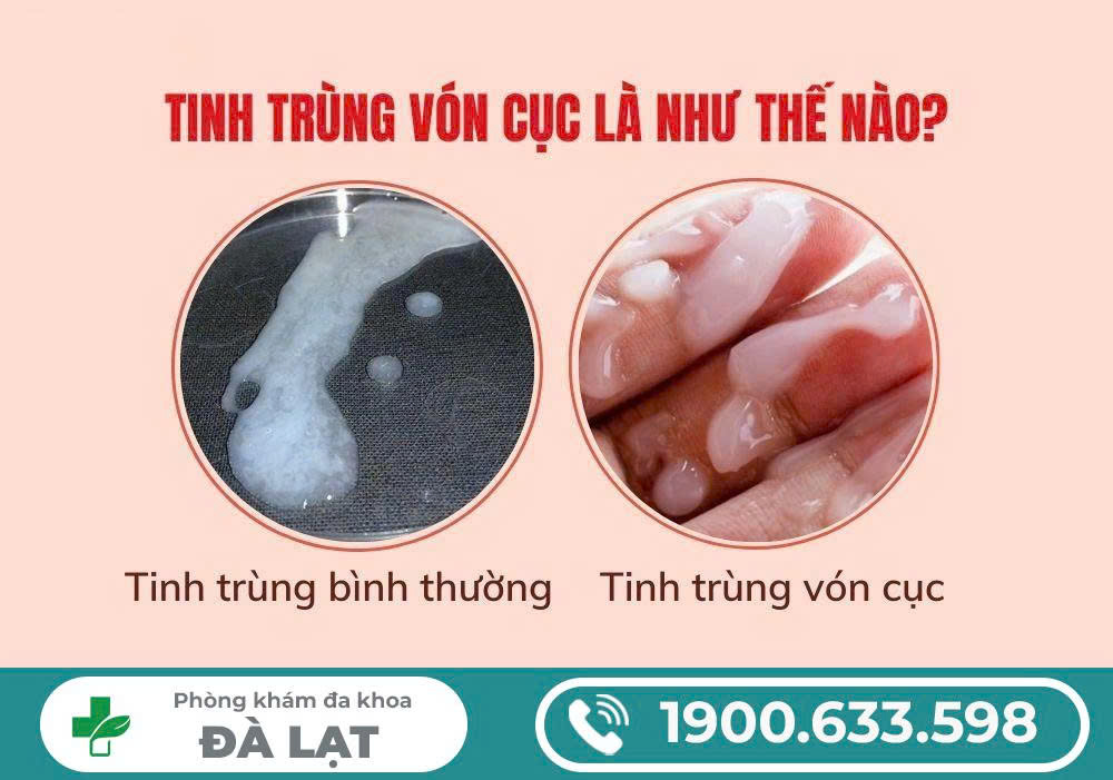 Hình ảnh minh họa