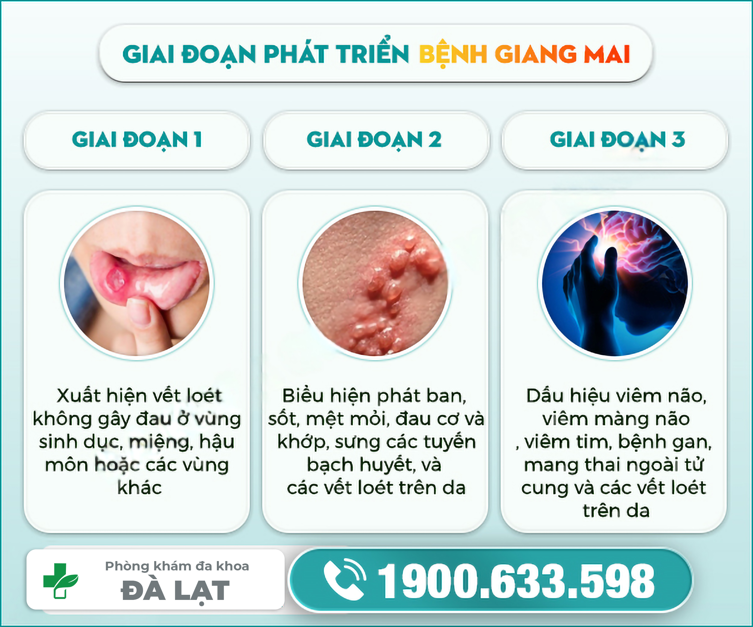 Hình ảnh minh họa