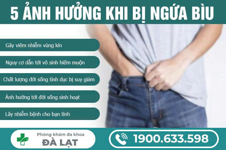 Hình ảnh minh họa