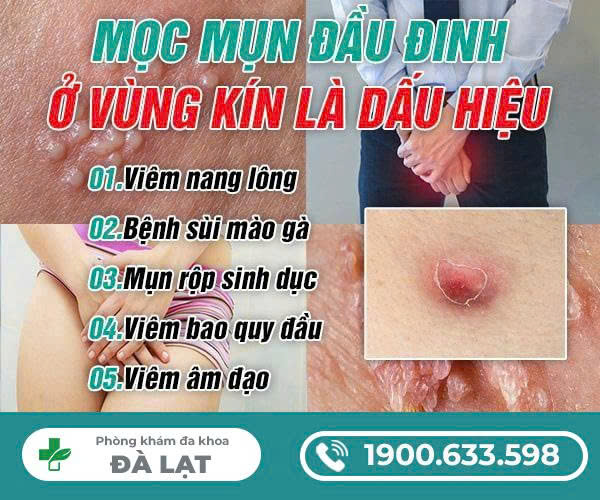 Hình ảnh minh họa
