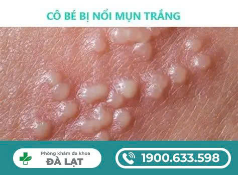 Hình ảnh minh họa