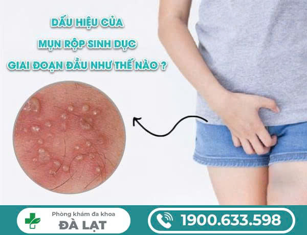 Hình ảnh minh họa