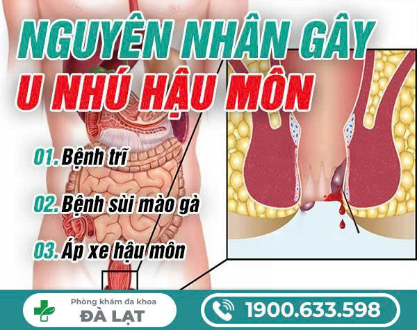 Hình ảnh minh họa