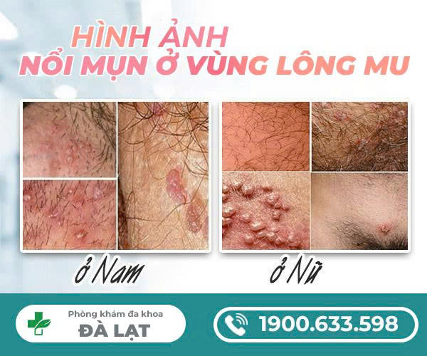 Hình ảnh minh họa