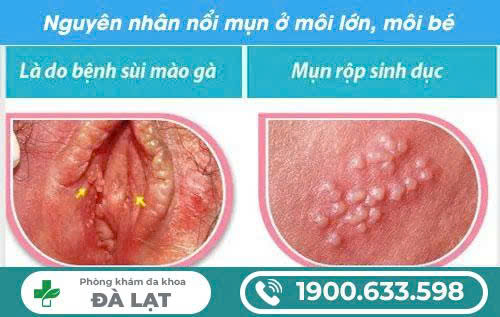 Hình ảnh minh họa