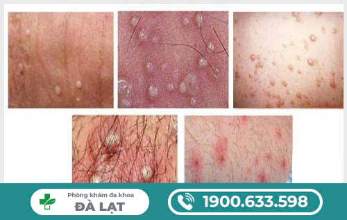 Hình ảnh minh họa