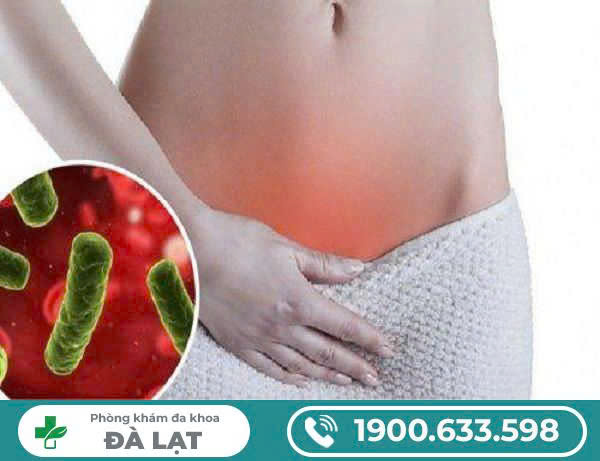 Hình ảnh minh họa