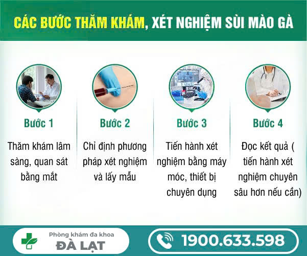 Hình ảnh minh họa