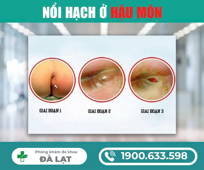 Hình ảnh minh họa