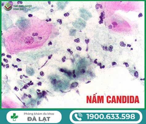 Hình ảnh minh họa