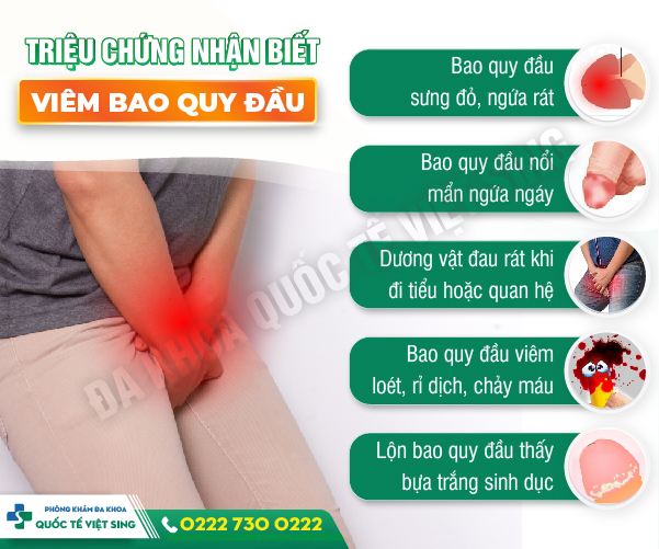 Hình ảnh minh họa