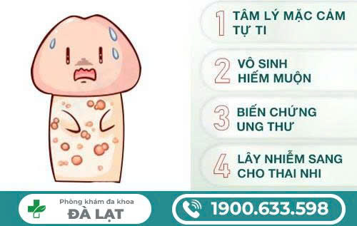 Hình ảnh minh họa