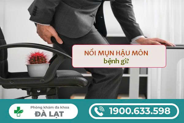 Hình ảnh minh họa