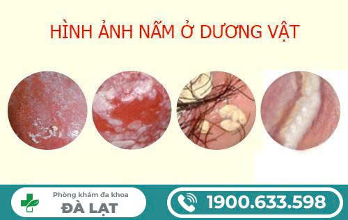 Hình ảnh minh họa