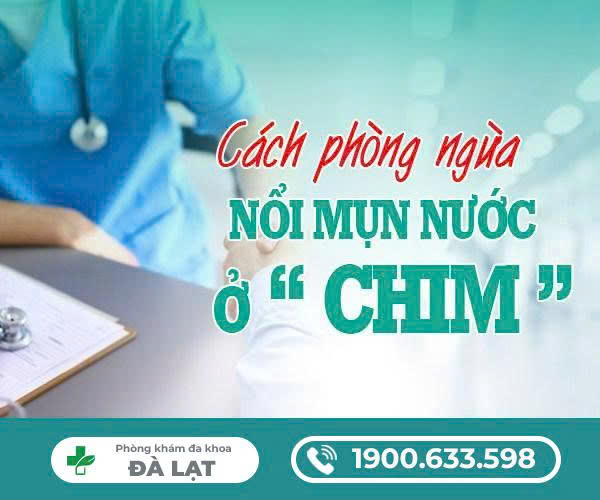 Hình ảnh minh họa