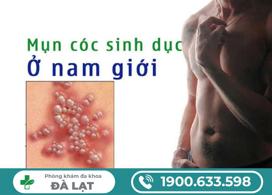 Hình ảnh minh họa